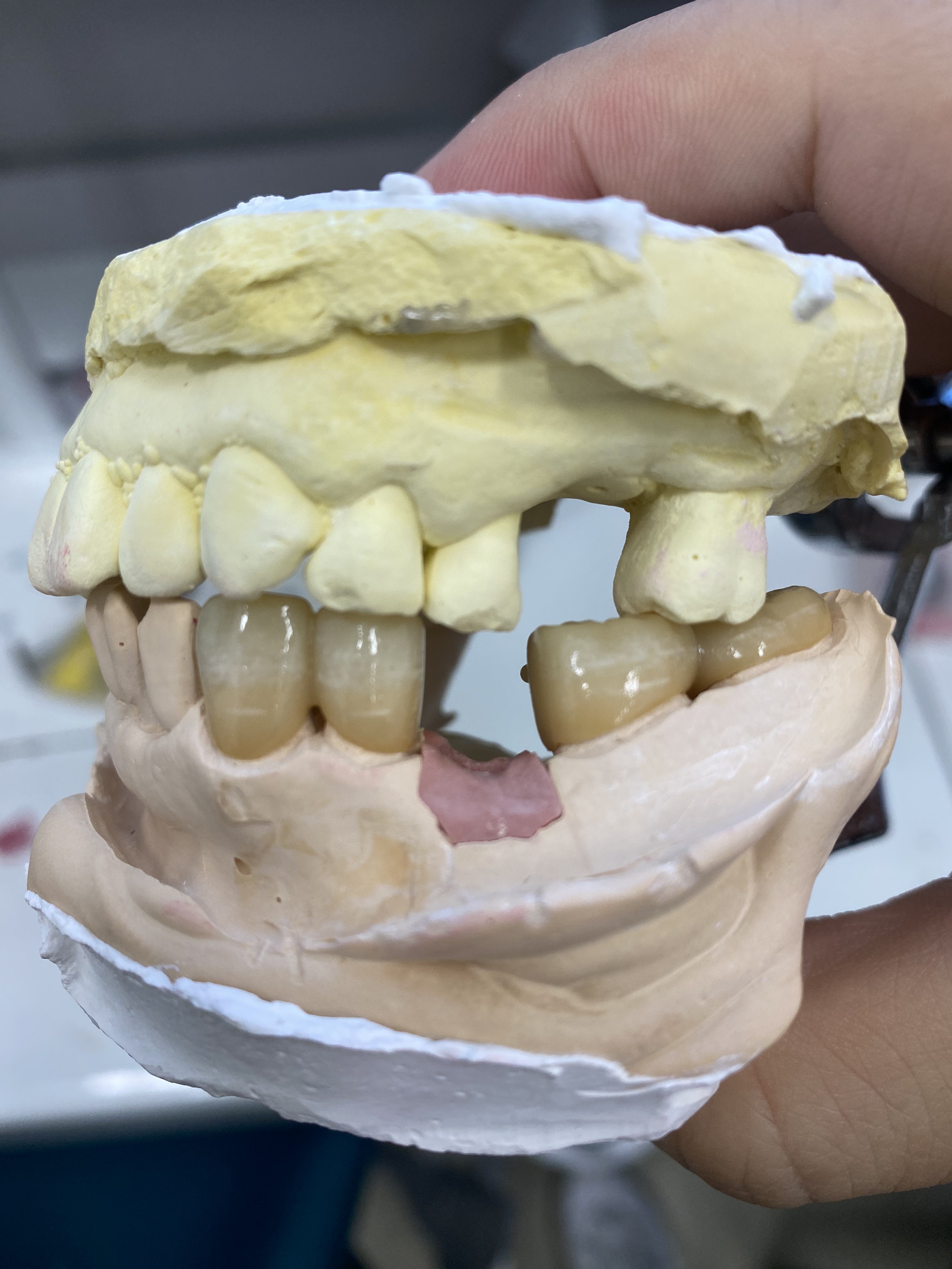 PFZ 브릿지 완성